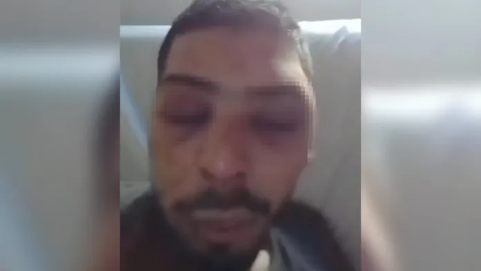 Joven fue víctima de una brutal agresión en Galarza: le daban “patadas y puñetazos en la cabeza”